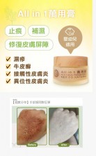 (現貨)Key to natural 濕疹皮膚推薦 ❤️ All in 1 皮膚萬用膏 #澳門製造⭐ #澳門品牌⭐ 特別採用用自家種植左手香純露(U1450)